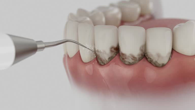Reliable Dental Implants contractor in Berwyn, PA by Smile Center Dentistry